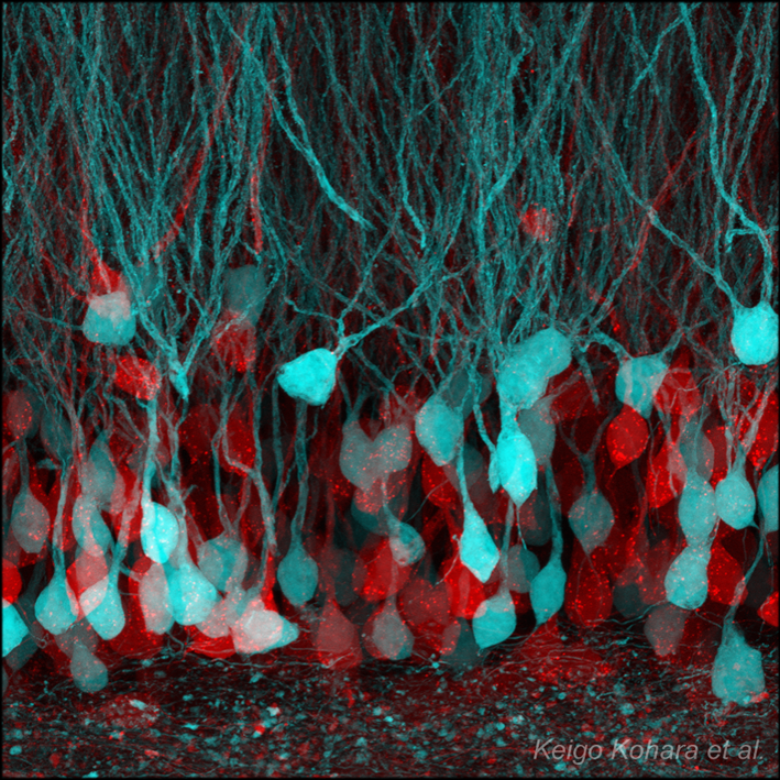 BATTLE-1により可視化された海馬歯状回神経細胞 3