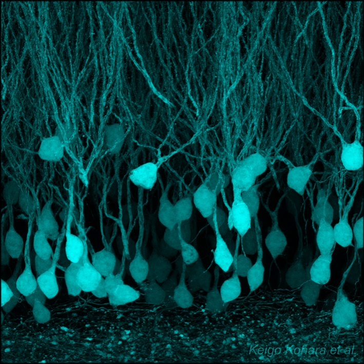 BATTLE-1により可視化された海馬歯状回神経細胞 1