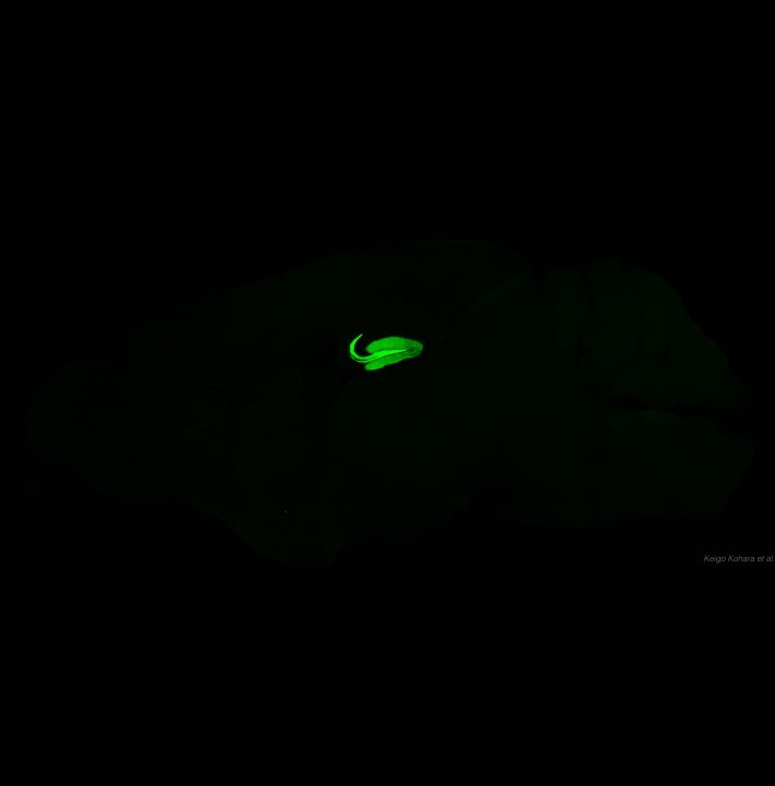 マウスの脳 (1)　緑色蛍光タンパク質GFPで可視化された海馬歯状回
