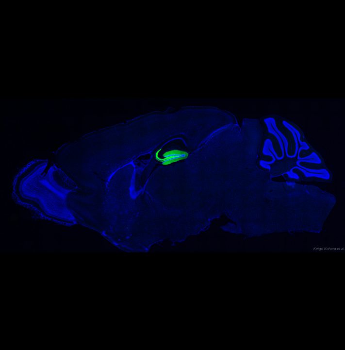 マウスの脳 (3)　緑色蛍光タンパク質GFPで可視化された海馬歯状回