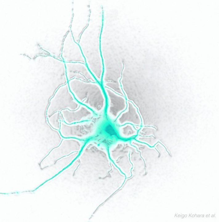 神経細胞 (1)